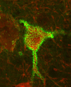 Slik ser en hjernecelle med perinevralt nettverk rundt seg ut. Det grønne er selve PNN som legger seg rundt cellen. Foto: Kristian Lensjø