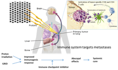 Ved å bestråle noen punkter i kreftsvulsten i lungen med protoner og kombinere det med immunterapi, er målsettingen at kroppens eget immunforsvar skal angripe kreftcellene som har spredt seg til andre organer. Illustrasjon:  ProGRID-prosjektet
