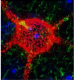 Aggrecan i hjernen:  Aggrecan-proteinet fremstår med rød farge, cellekjernene er blå, mens grønn farge markerer kontaktpunkter på en celletype som de perinevrale nettene pleier å ligge rundt. Foto: Kristian Lensjø/UiO