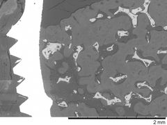 Bildet viser gjenværende titanpartikler (lyse grå felt) spredt i beinmassen (mørkere felt). Til venstre ser en tydelig et implantat som er festet i kjevebeinet. Foto: Anders Verket, OD/UiO.